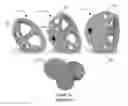 Fig. 22 - Iliac canal prosthesis
