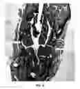 Fig. 17 - MATERIALS AND METHODS FOR TREATING CRITICALLY SIZED DEFECTS IN MOUSE BONE