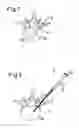 Fig. 02 - Filler Means, Feeding Device and Method for the Forming of a Support Structure in a Bone Cavity