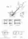 Fig. 08 - Filler Means, Feeding Device and Method for the Forming of a Support Structure in a Bone Cavity