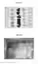 Fig. 06 - Method for separating mineral impurities from calcium carbonate-containing rocks by X-ray sorting