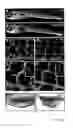 Fig. 02 - Methods for Identifying Modulating Compounds of Lymphangiogenesis, Means Therefore, Compounds and Uses Thereof
