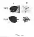 Fig. 02 - Expression cassettes for transgenic expression of nucleic acids