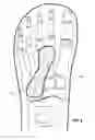 Fig. 08 - SHOE APPLIANCE WITH AN ORTHOPEDIC DEVICE