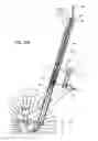 Fig. 45 - Cable Splicing Assembly for Convertible Stroller-Cycle
