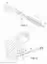 Fig. 02 - Internally Braced Radial Balloon Dilator