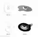 Fig. 08 - Layered nasal respiratory devices