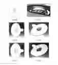 Fig. 09 - Layered nasal respiratory devices
