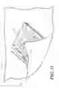 Fig. 20 - Catheter tray, packaging system, instruction insert, and associated methods