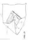Fig. 22 - Catheter tray, packaging system, instruction insert, and associated methods