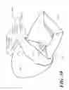 Fig. 34 - Catheter tray, packaging system, instruction insert, and associated methods