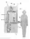 Fig. 01 - Safety insert for extra-corporeal circuits