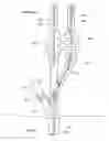 Fig. 01 - Method and apparatus to control fluid flow from subsea wells