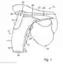 Fig. 02 - Fluid container carrying device and a neck protection device provided with such a fluid container carrying device