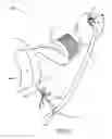 Fig. 09 - Hand Tool Cord Tether and Method