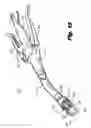 Fig. 08 - Staple buttress retention system