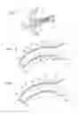Fig. 02 - Device for taking impression of an ear