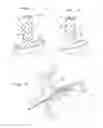 Fig. 03 - Device for taking impression of an ear