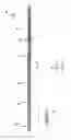 Fig. 01 - System and method for damping vibration in a drill string