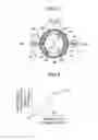 Fig. 04 - Attachment structure of stabilizer link