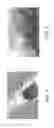 Fig. 02 - System and method for detection of flexible pipe armor wire ruptures