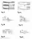 Fig. 15 - Methods and systems for improving iterative signal processing