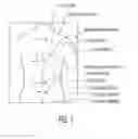 Fig. 02 - System for positioning and X-ray imaging a heart