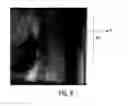 Fig. 09 - System for positioning and X-ray imaging a heart
