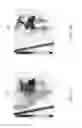 Fig. 08 - Method and computer for aiding determination of obstructive sleep apnea