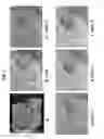 Fig. 09 - Techniques for tomographic image by background subtraction