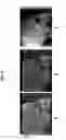 Fig. 10 - Techniques for tomographic image by background subtraction