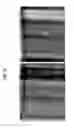 Fig. 13 - Techniques for tomographic image by background subtraction