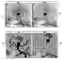 Fig. 01 - Medical image processing and registration system