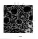 Fig. 09 - Epithelial structure detector and related methods