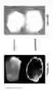 Fig. 11 - Method and system for determining the quality of pharmaceutical products