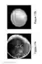 Fig. 19 - Method and system for determining the quality of pharmaceutical products
