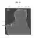 Fig. 08 - IMAGE PROCESSING APPARATUS AND METHOD, AND PROGRAM
