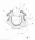 Fig. 03 - Ball joint and method for the production thereof