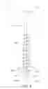 Fig. 04 - Screw with double notches