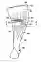 Fig. 01 - Composite aerofoil