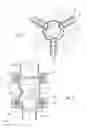 Fig. 03 - BALL VALVE DEVICE AND METHOD FOR FORMING A BALL RETAINER IN A CHECK VALVE