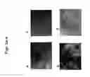 Fig. 09 - METHODS FOR CELL EXPANSION AND USES OF CELLS AND CONDITIONED MEDIA PRODUCED THEREBY FOR THERAPY
