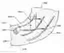 Fig. 01 - METHOD OF TREATING CORONARY ARTERIES WITH PERIVASCULAR DELIVERY OF THERAPEUTIC AGENTS