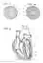 Fig. 02 - METHOD OF TREATING CORONARY ARTERIES WITH PERIVASCULAR DELIVERY OF THERAPEUTIC AGENTS