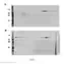 Fig. 07 - Disease control with tick phospholipase A