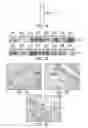 Fig. 08 - ANNEXIN A2 AS IMMUNOLOGICAL TARGET