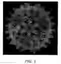 Fig. 02 - SELF-ASSEMBLING NANOPARTICLE DRUG DELIVERY SYSTEM