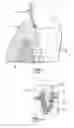 Fig. 02 - System and method for detection and removal of dental tartar