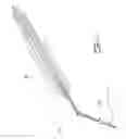 Fig. 16 - System and method for detection and removal of dental tartar