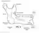 Fig. 07 - Training aid for a dental injection